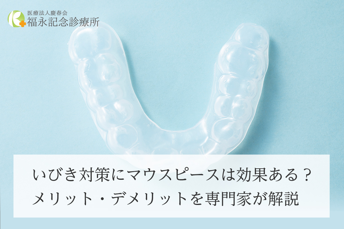 いびき対策にマウスピースは効果ある?メリット・デメリットを専門家が解説